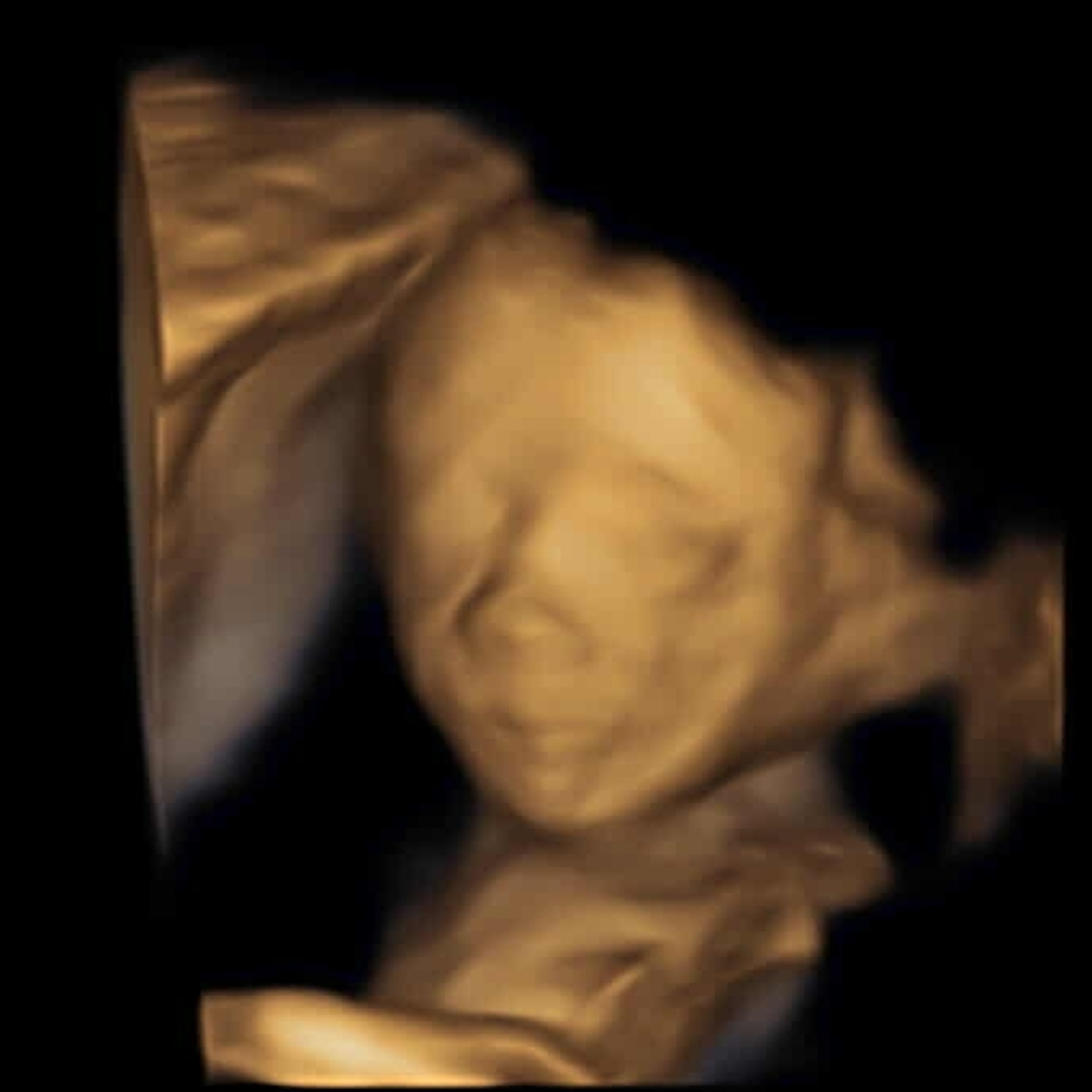 Photo shared by Kristen for their Babylist baby registry.