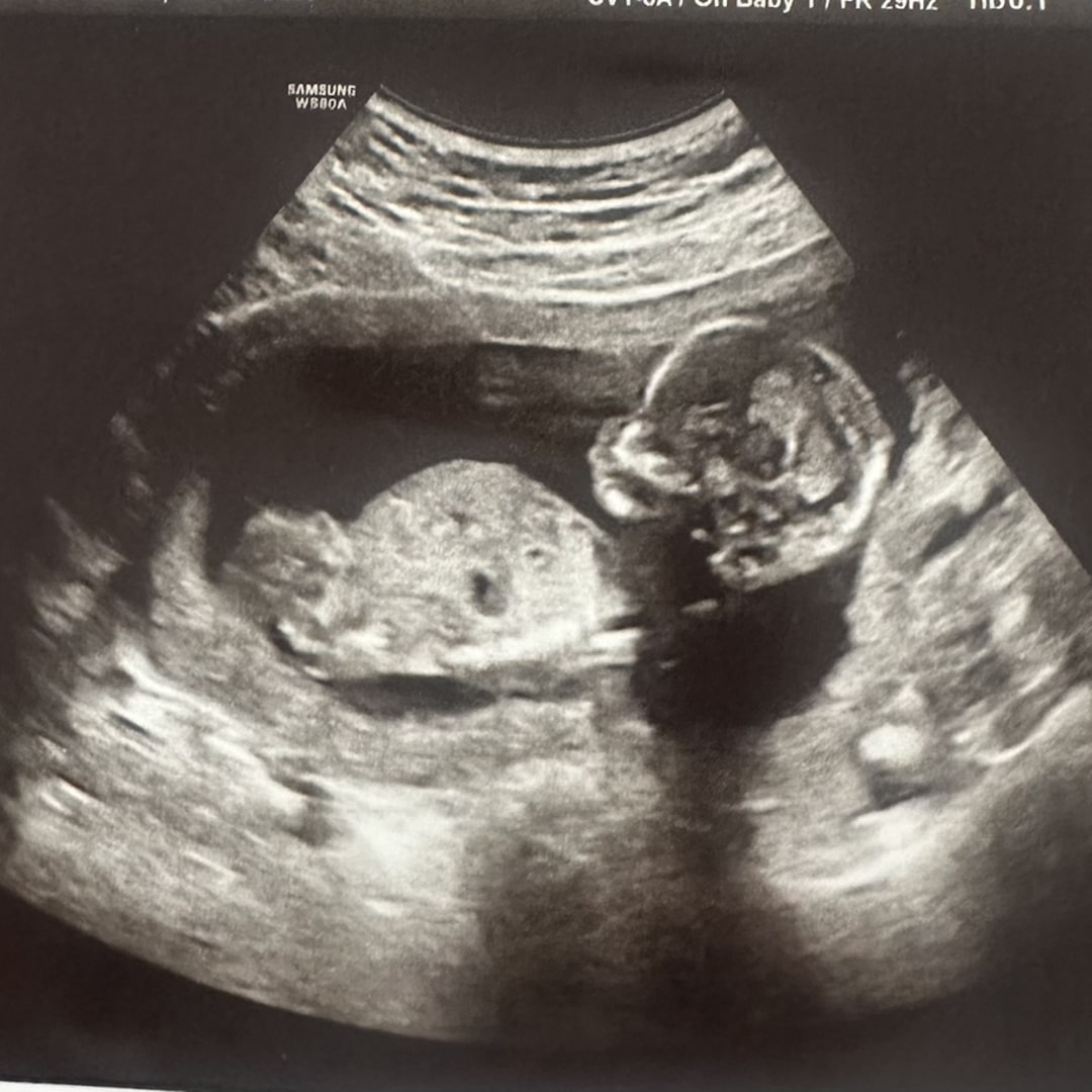 Photo shared by Michelle for their Babylist baby registry.