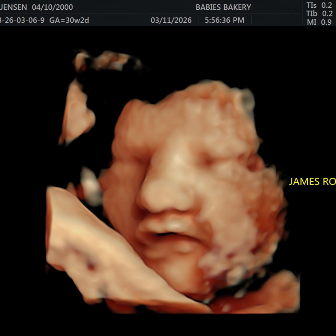 Photo shared by Jensen for their Babylist baby registry.