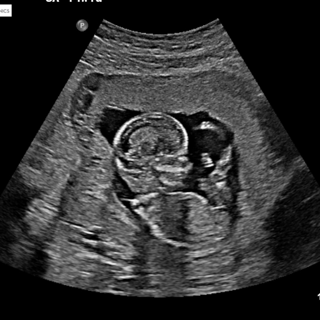 Photo shared by Danielle for their Babylist baby registry.