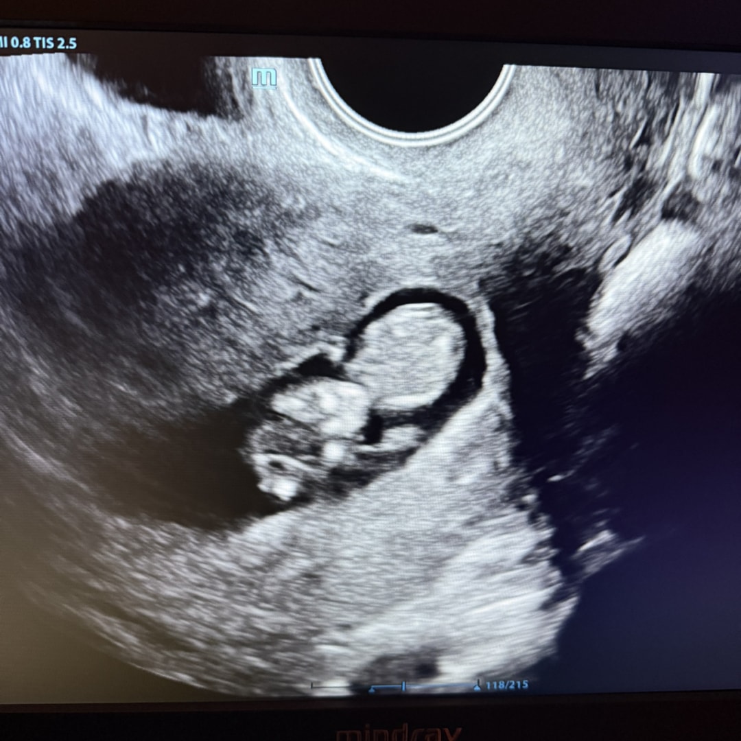 Photo shared by Bridney for their Babylist baby registry.