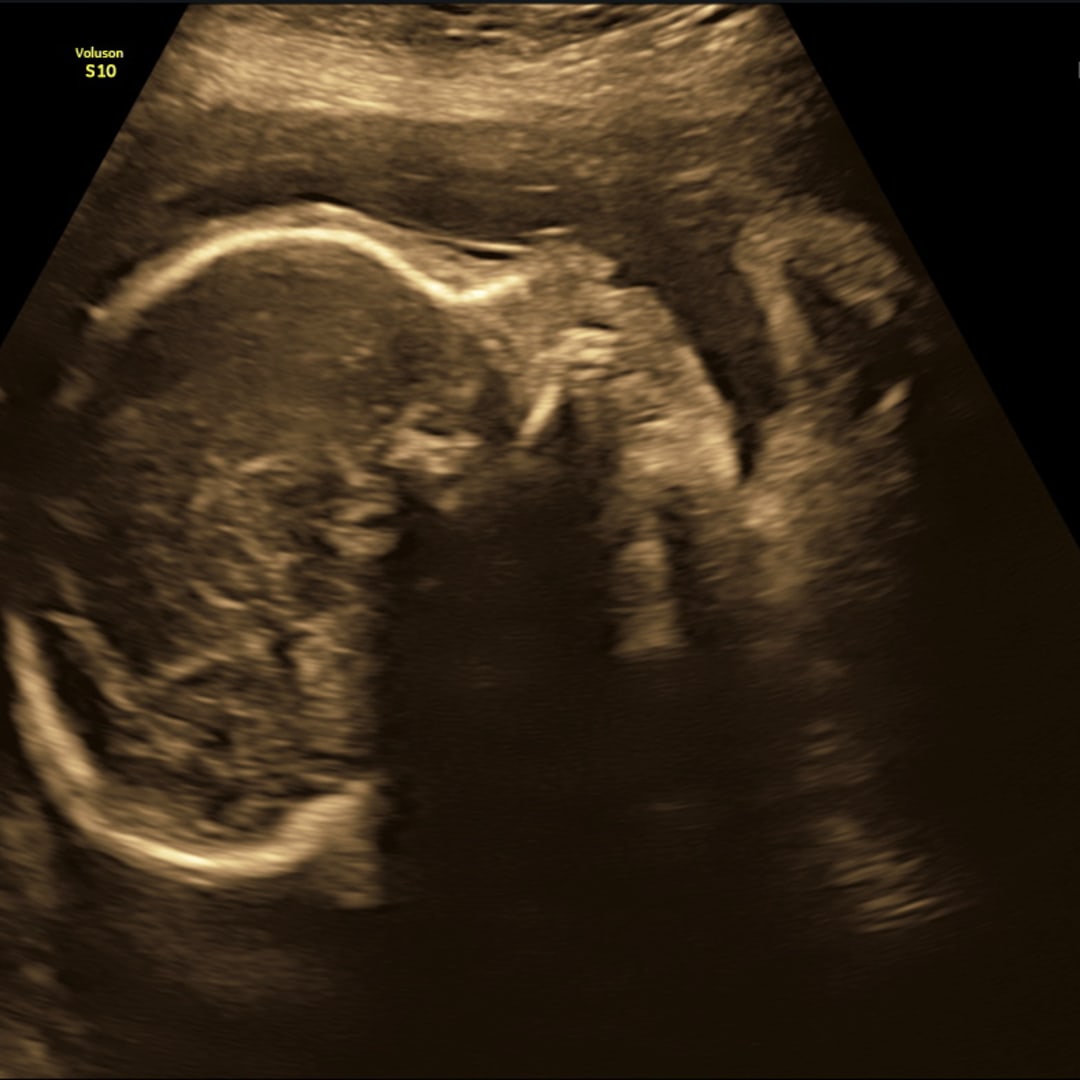 Photo shared by Daniel for their Babylist baby registry.