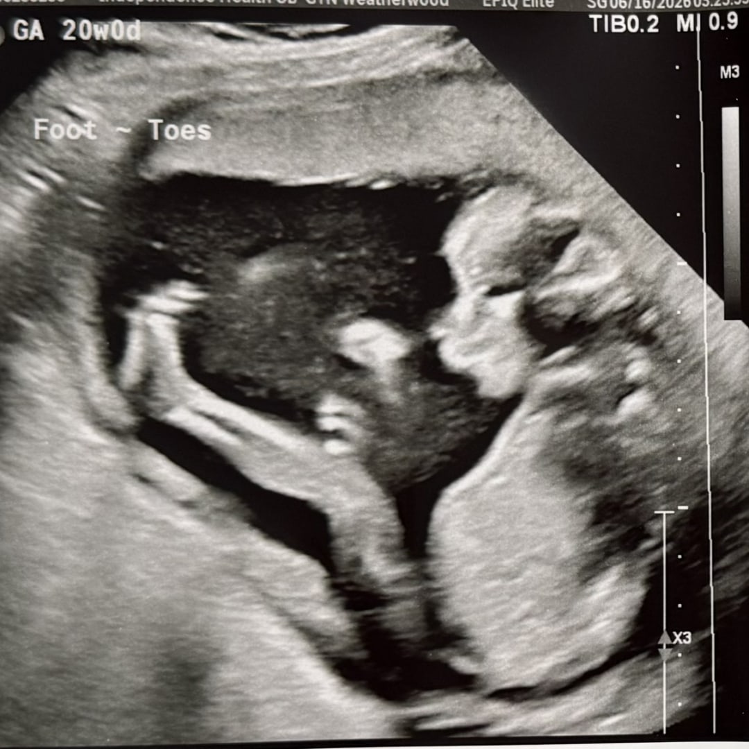 Photo shared by Chelsea for their Babylist baby registry.