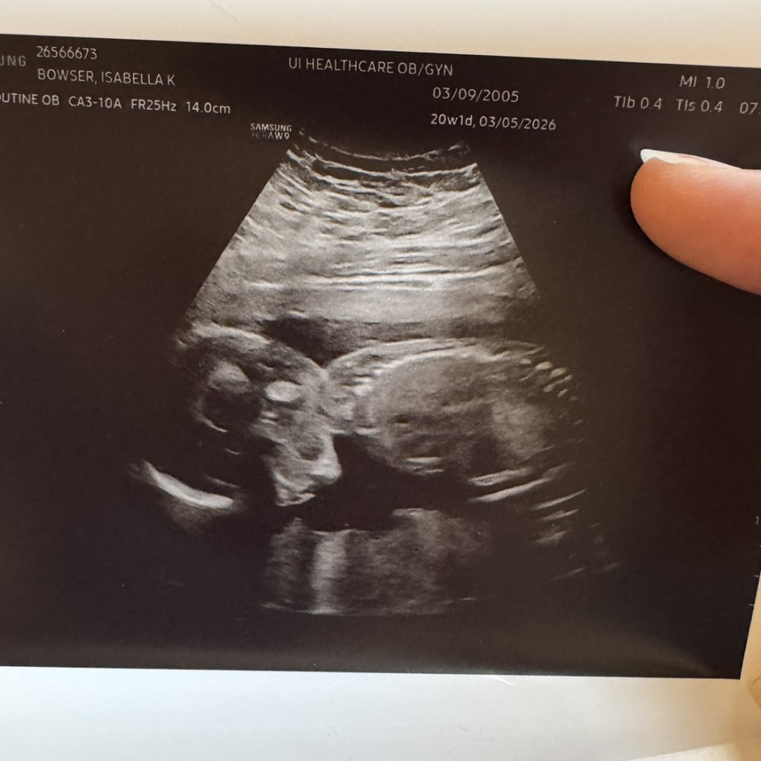 Photo shared by Isabella for their Babylist baby registry.