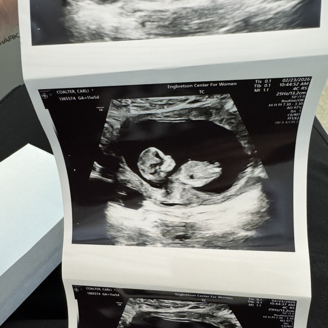 Photo shared by Carli for their Babylist baby registry.