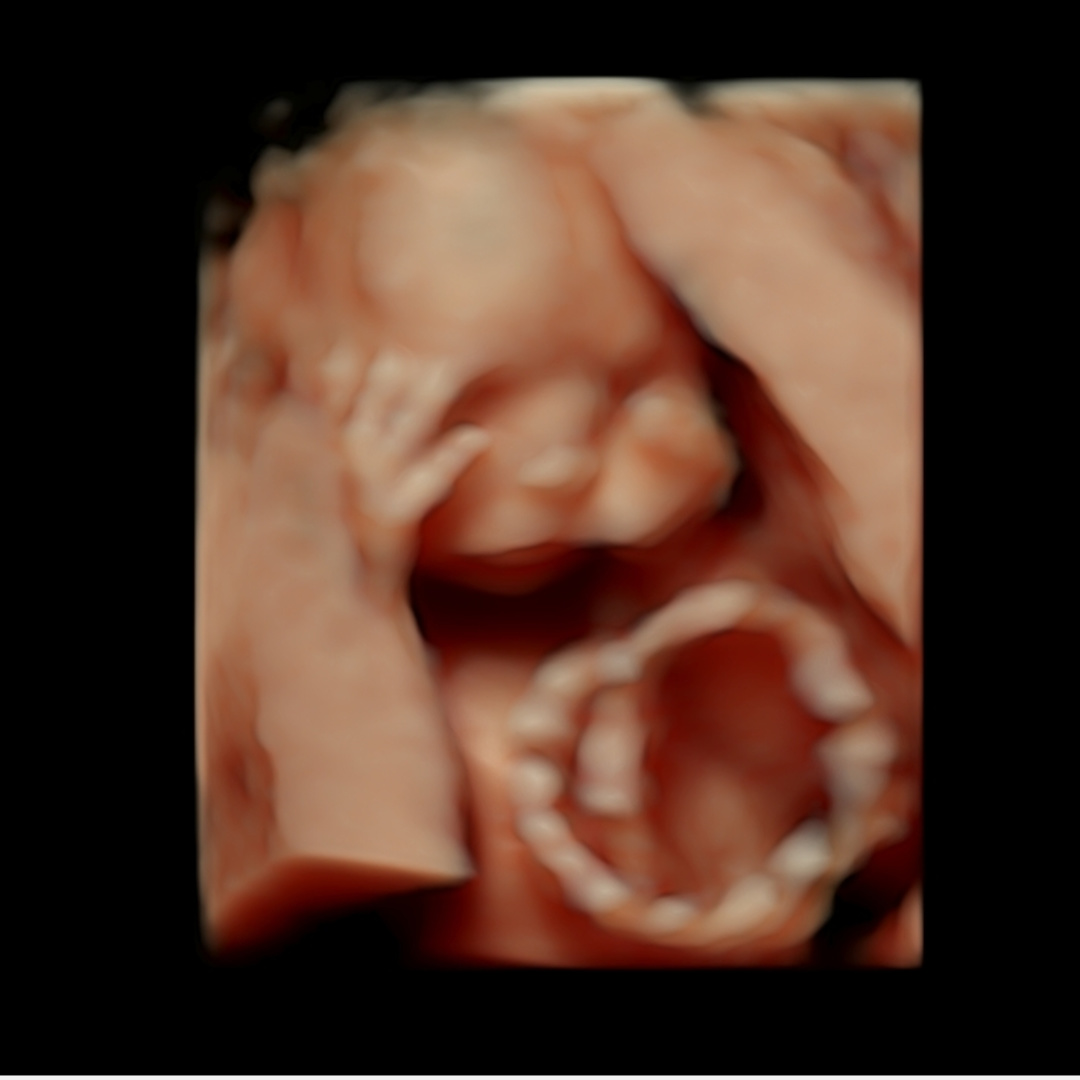 Photo shared by Abi for their Babylist baby registry.