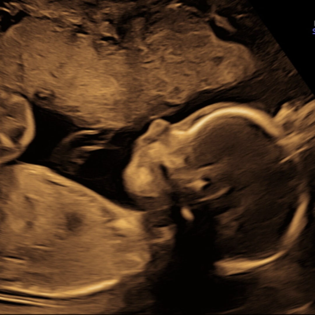 Photo shared by Ellie for their Babylist baby registry.