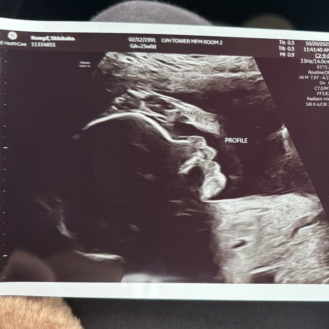 Photo shared by Shiobahn for their Babylist baby registry.