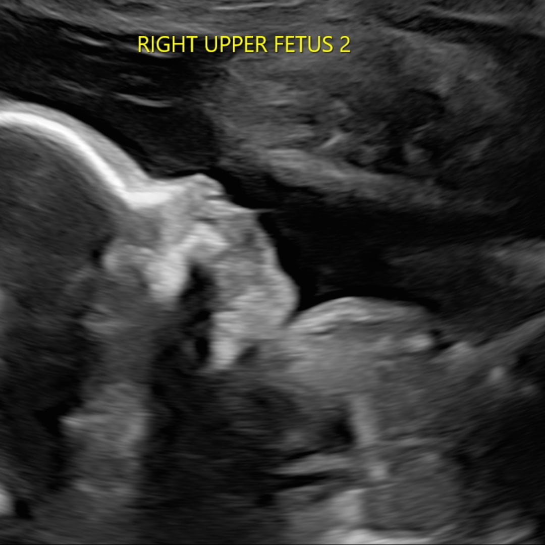 Photo shared by Alyssa for their Babylist baby registry.