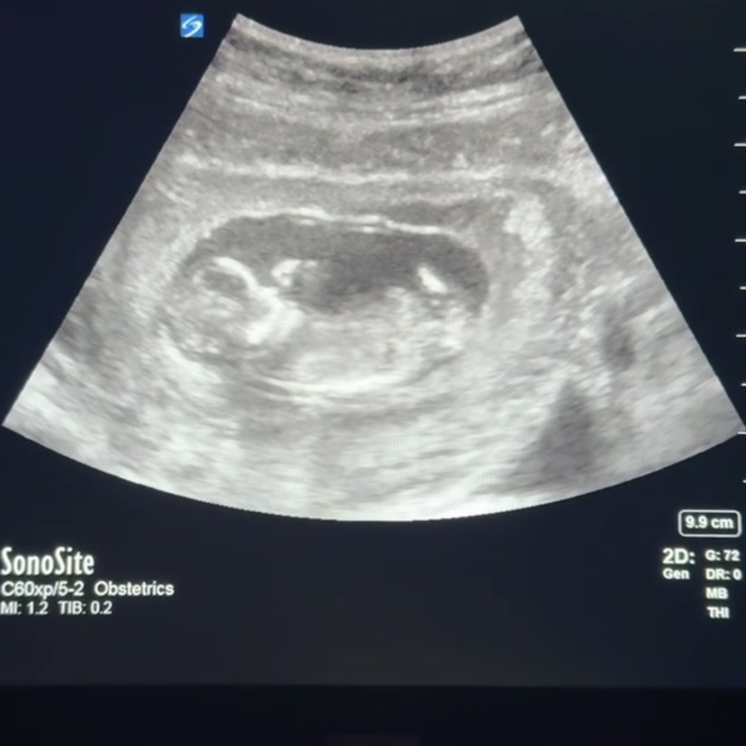 Photo shared by Mary & Nick for their Babylist baby registry.