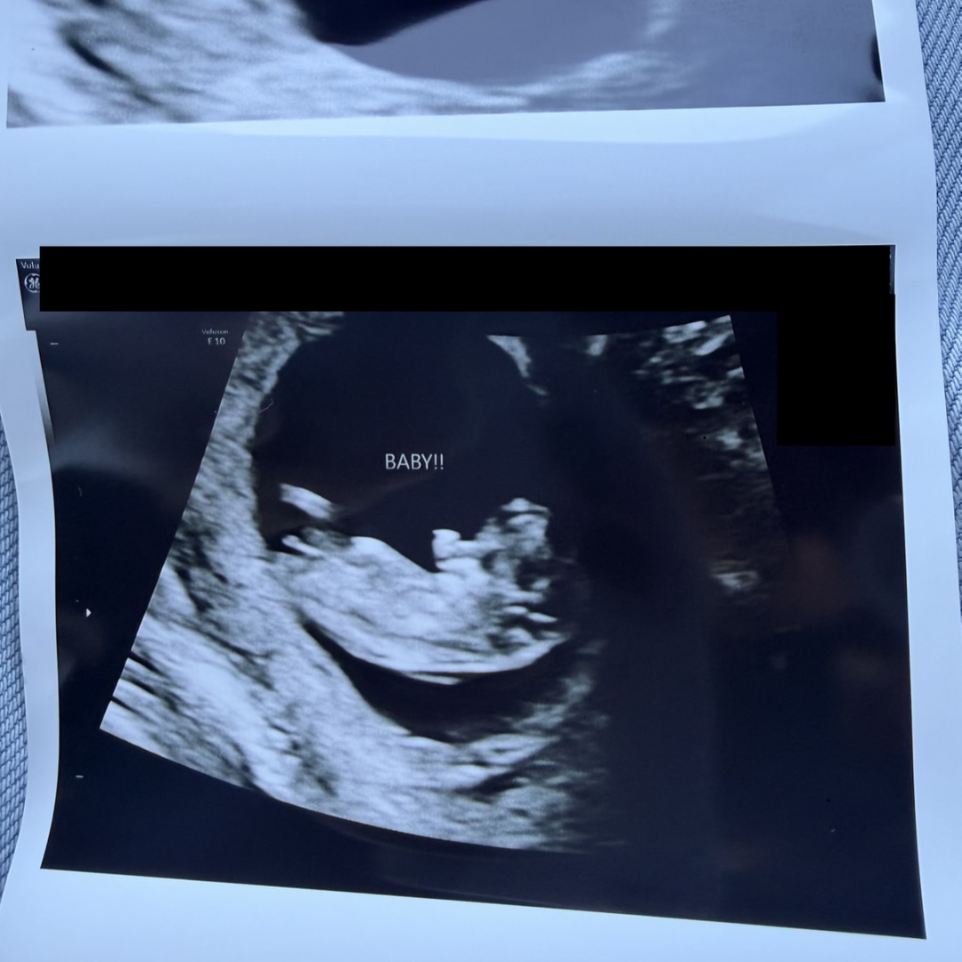 Photo shared by Remy for their Babylist baby registry.
