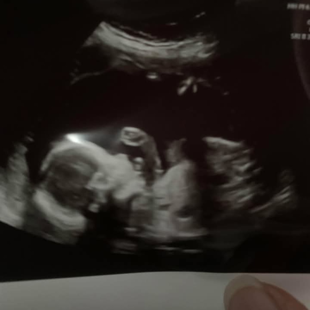 Photo shared by Justina for their Babylist baby registry.