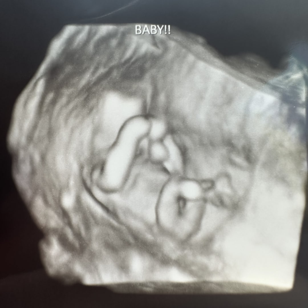 Photo shared by Alexa for their Babylist baby registry.