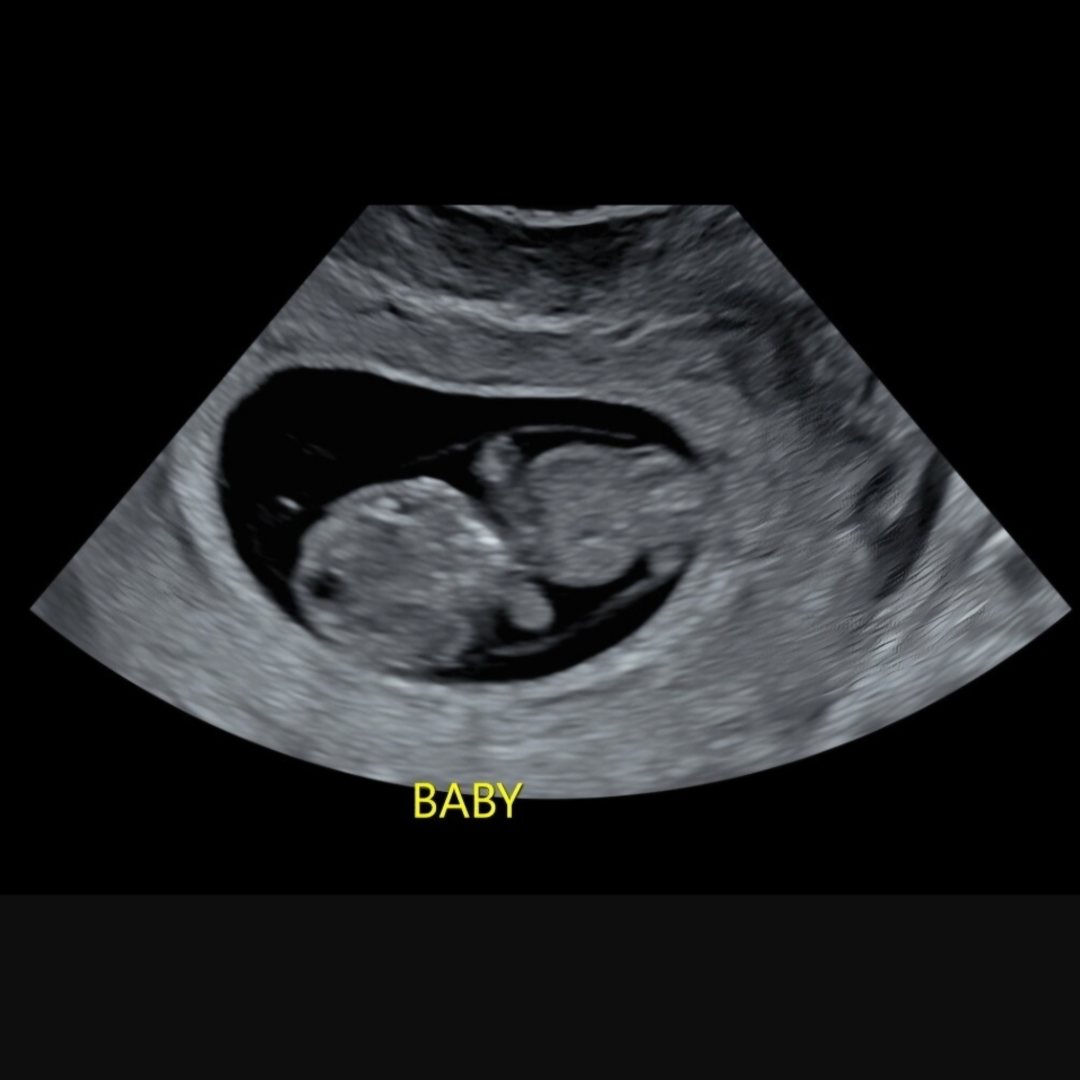 Photo shared by Molly for their Babylist baby registry.