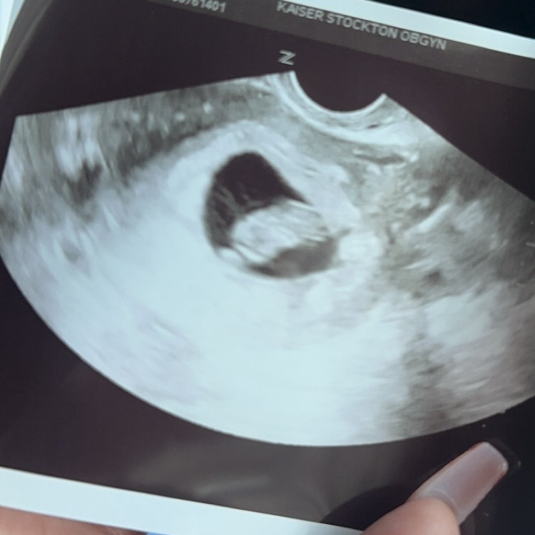 Photo shared by Melanie for their Babylist baby registry.