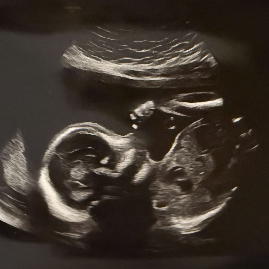 Photo shared by Valeria for their Babylist baby registry.