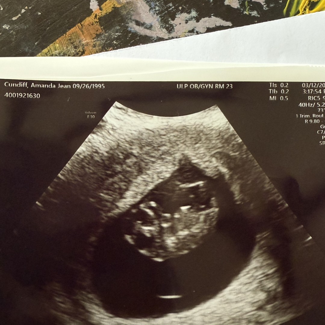 Photo shared by Amanda for their Babylist baby registry.