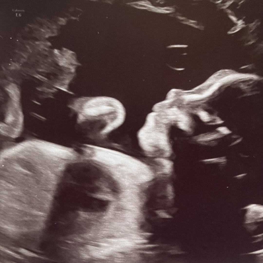 Photo shared by Tori for their Babylist baby registry.