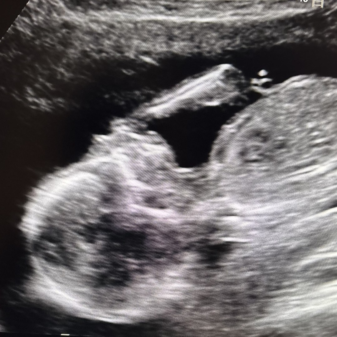Photo shared by Desirae for their Babylist baby registry.