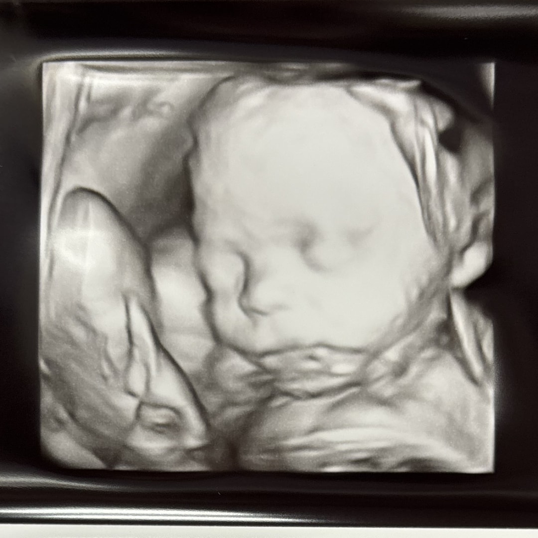 Photo shared by Gianna for their Babylist baby registry.