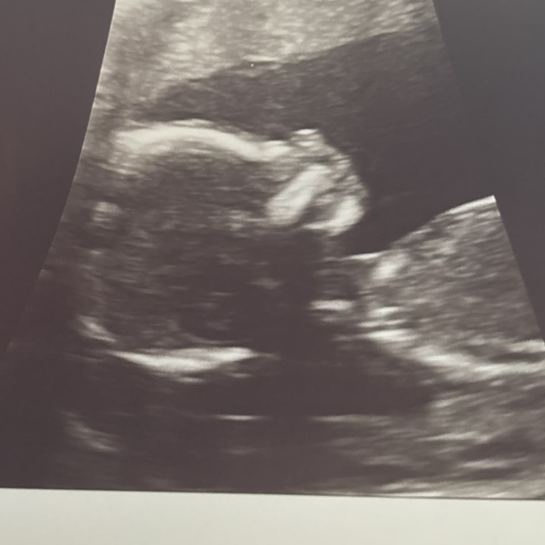 Photo shared by Allie for their Babylist baby registry.