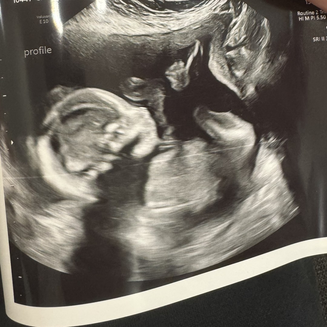 Photo shared by Breanna for their Babylist baby registry.