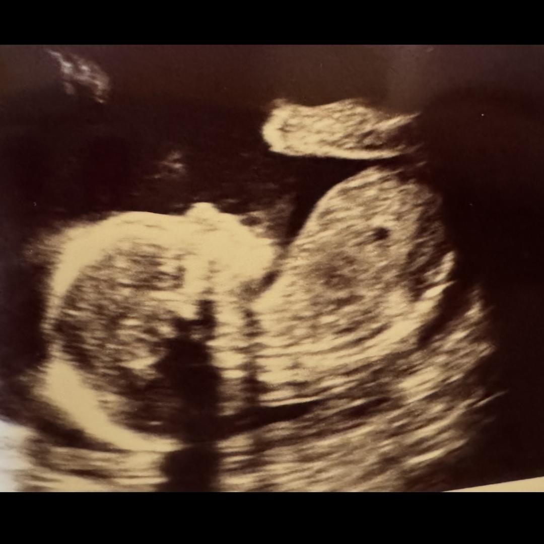 Photo shared by Alysha for their Babylist baby registry.