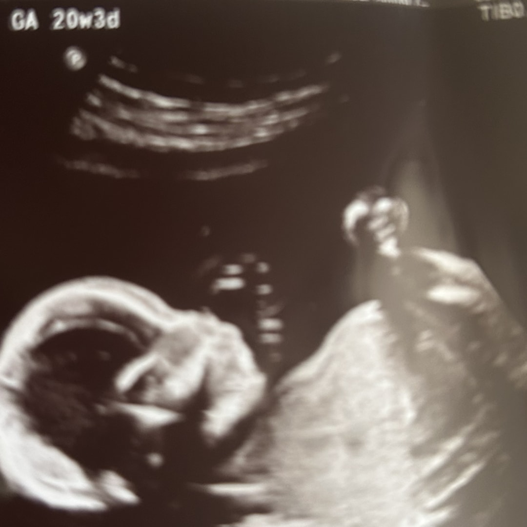 Photo shared by Claire for their Babylist baby registry.