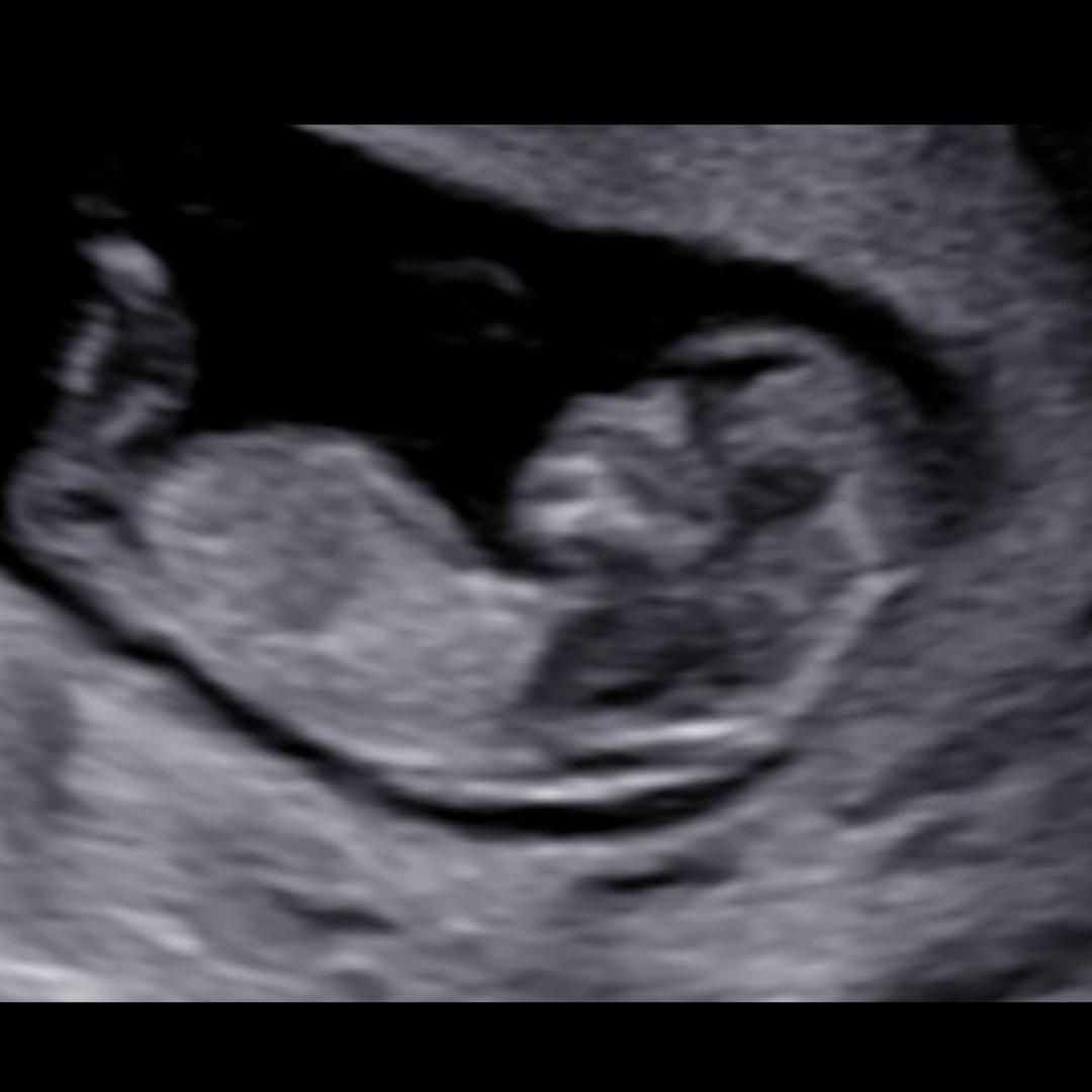 Photo shared by Shelbie for their Babylist baby registry.