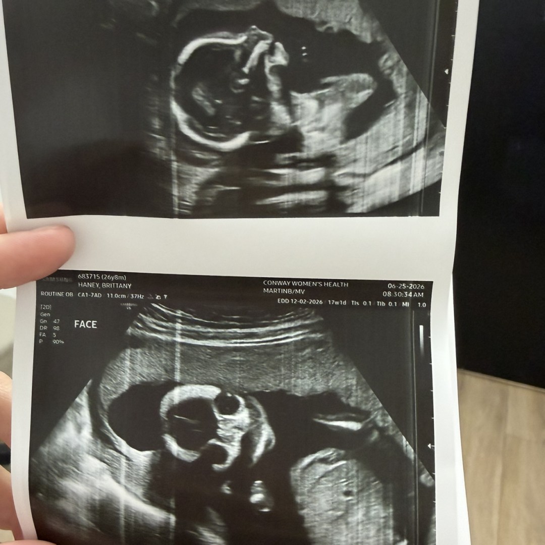 Photo shared by Brittany for their Babylist baby registry.