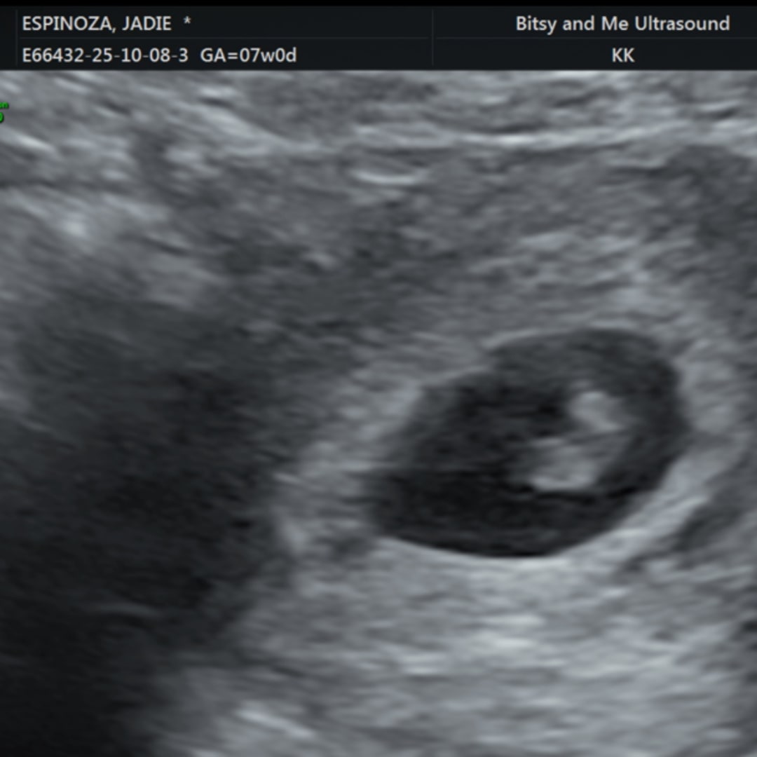 Photo shared by Jadie for their Babylist baby registry.