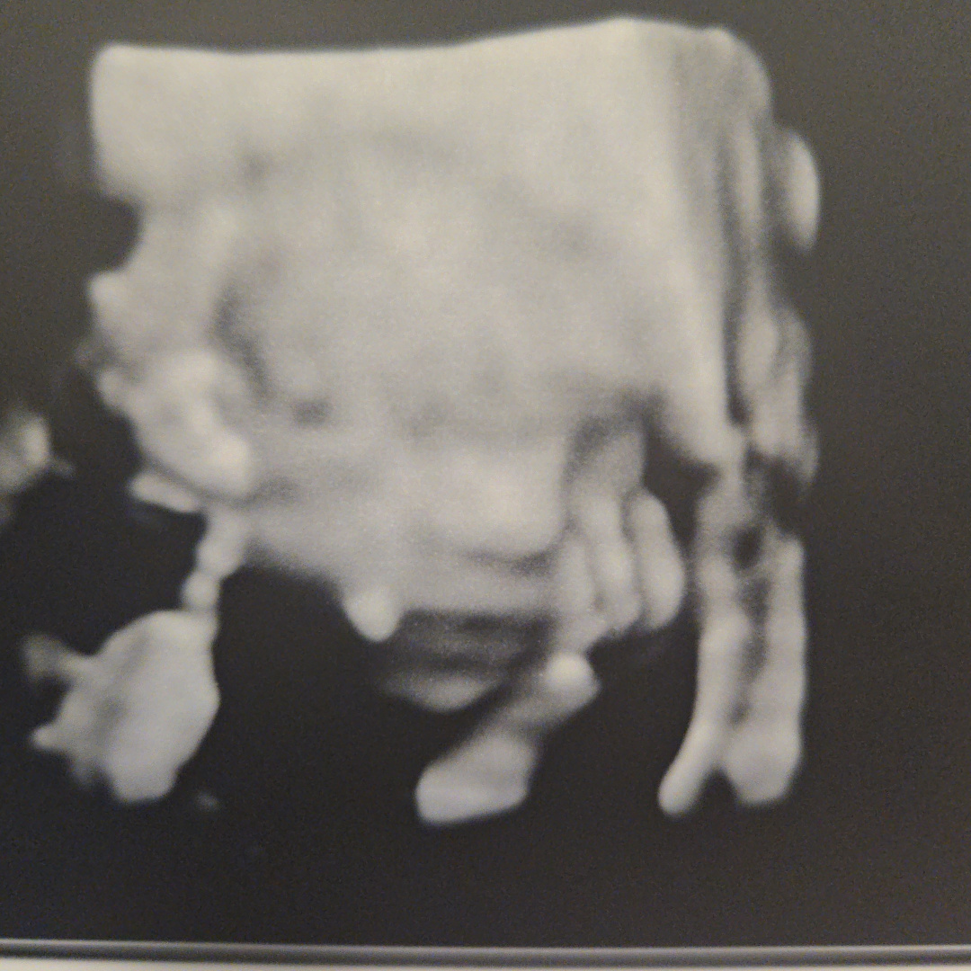Photo shared by Hannah for their Babylist baby registry.