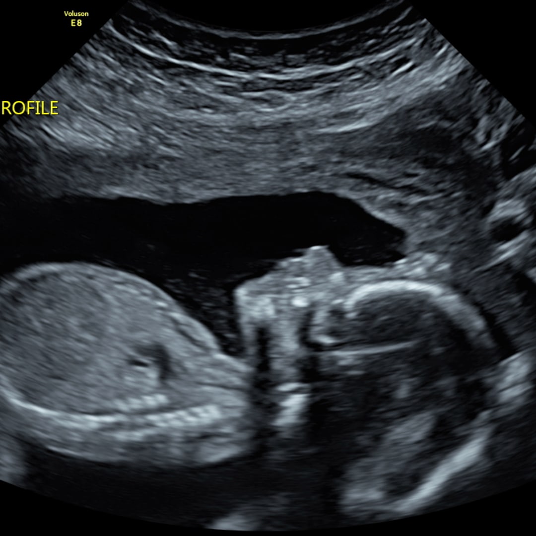 Photo shared by Kate for their Babylist baby registry.