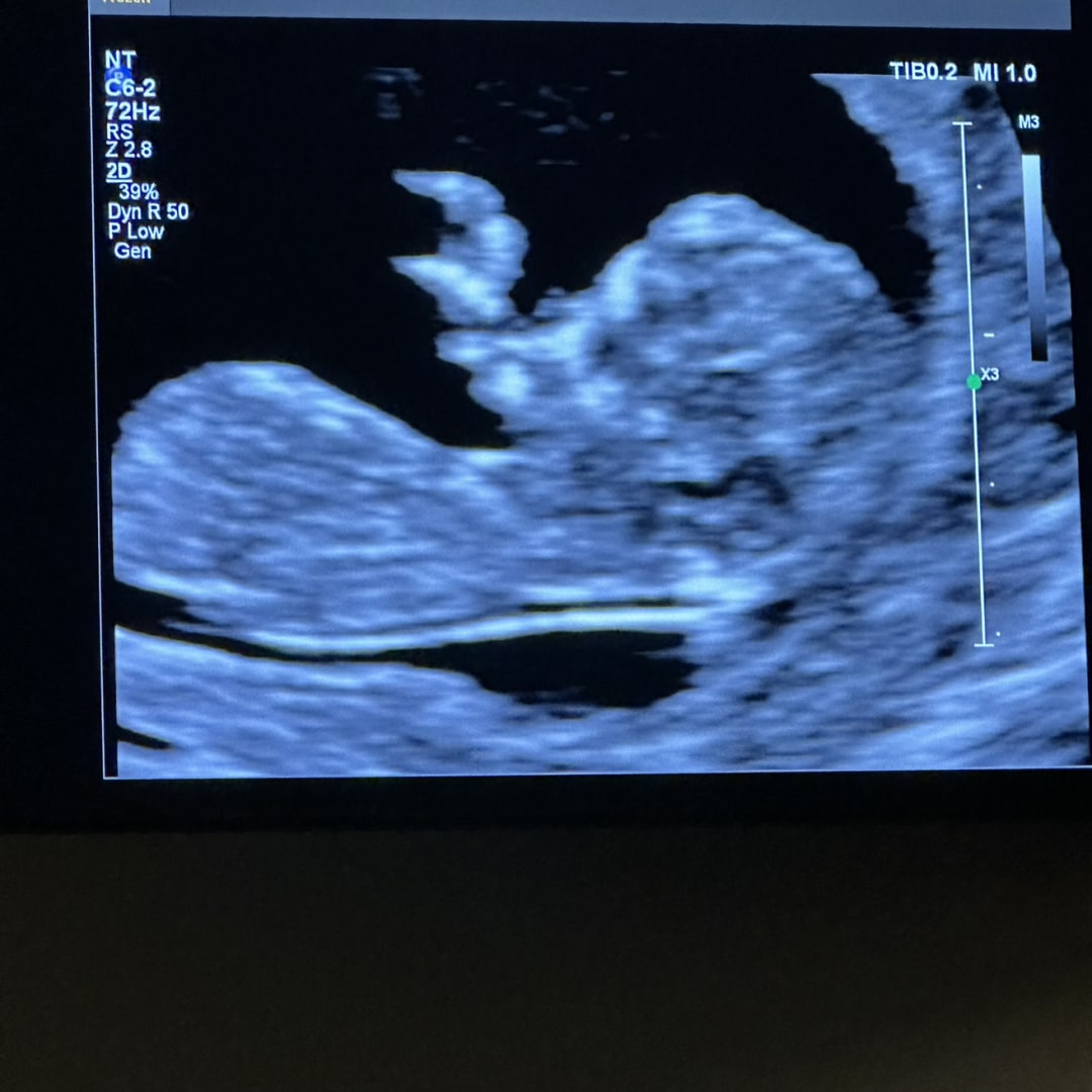 Photo shared by Hayden for their Babylist baby registry.