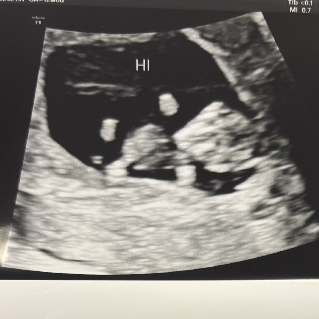 Photo shared by Jamie for their Babylist baby registry.