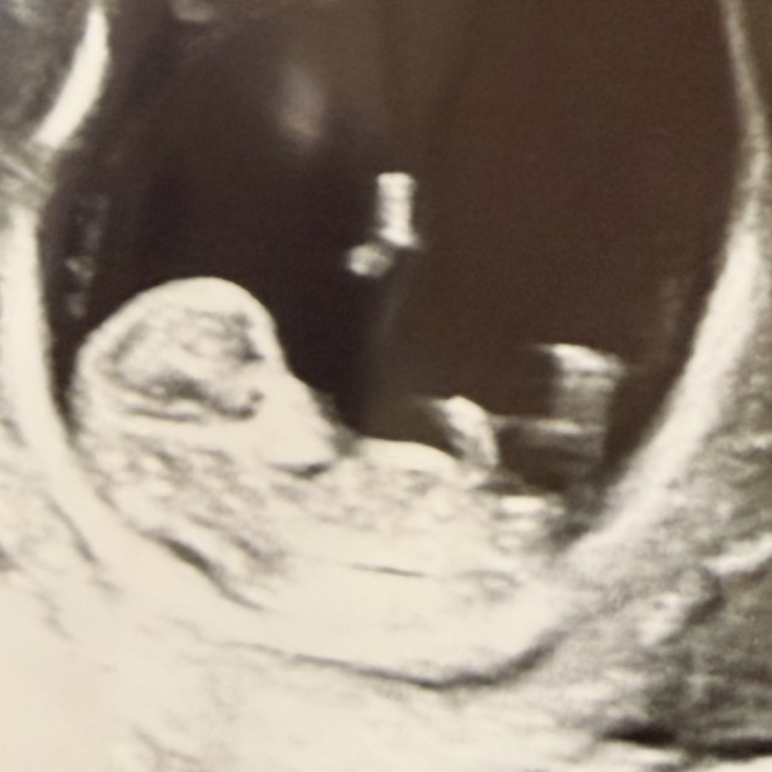 Photo shared by Julia for their Babylist baby registry.