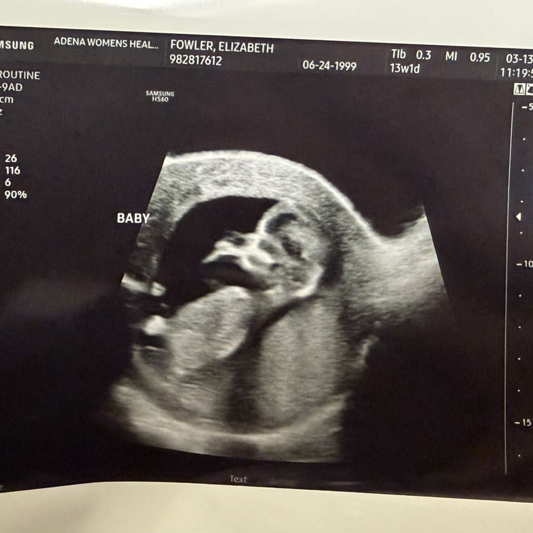 Photo shared by Elizabeth for their Babylist baby registry.