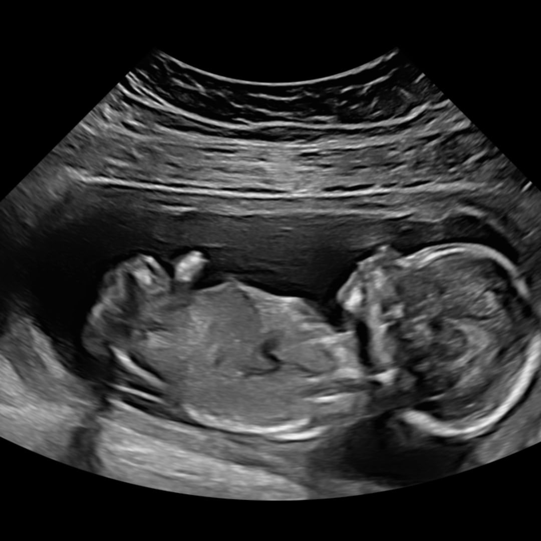 Photo shared by Brooke for their Babylist baby registry.