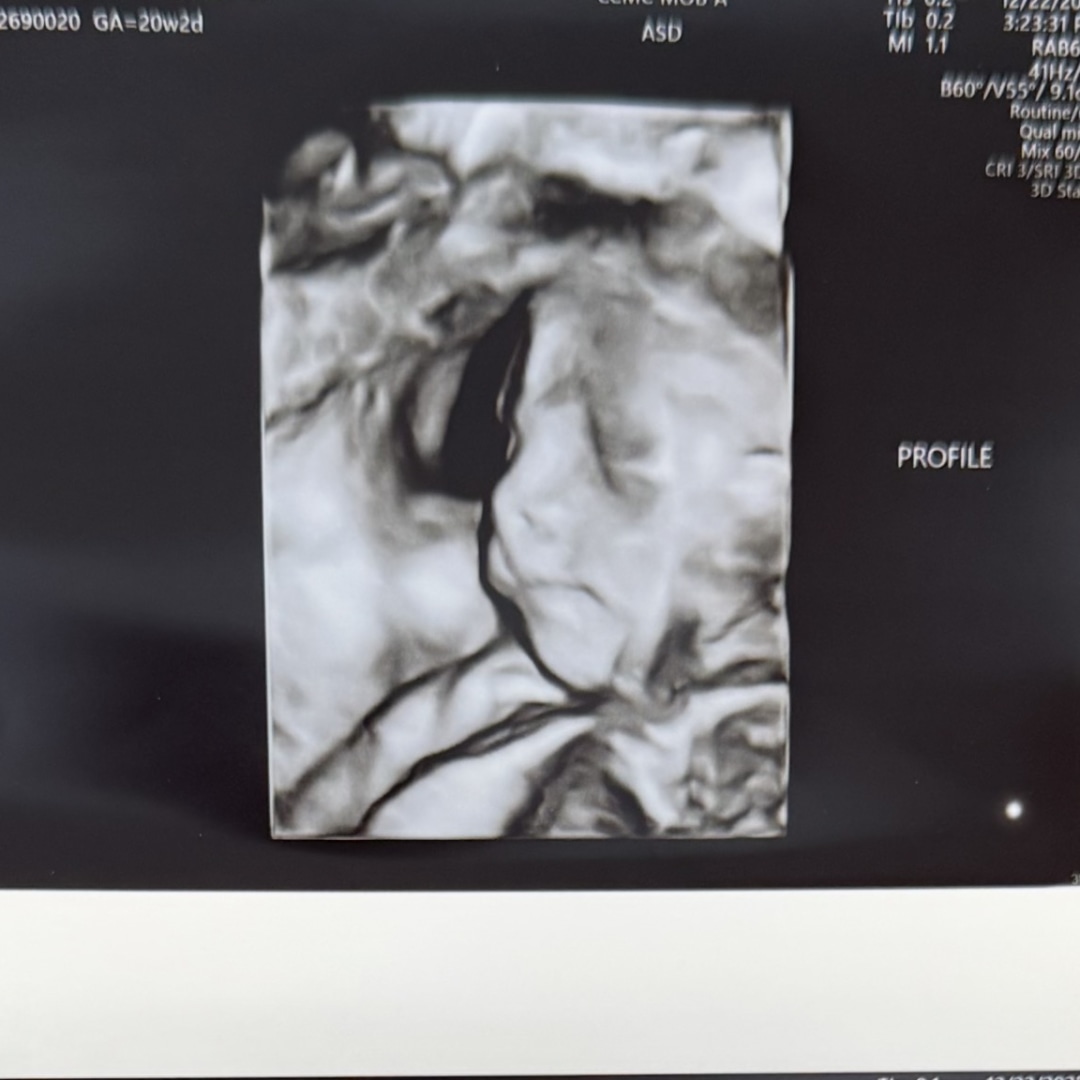 Photo shared by Emily for their Babylist baby registry.