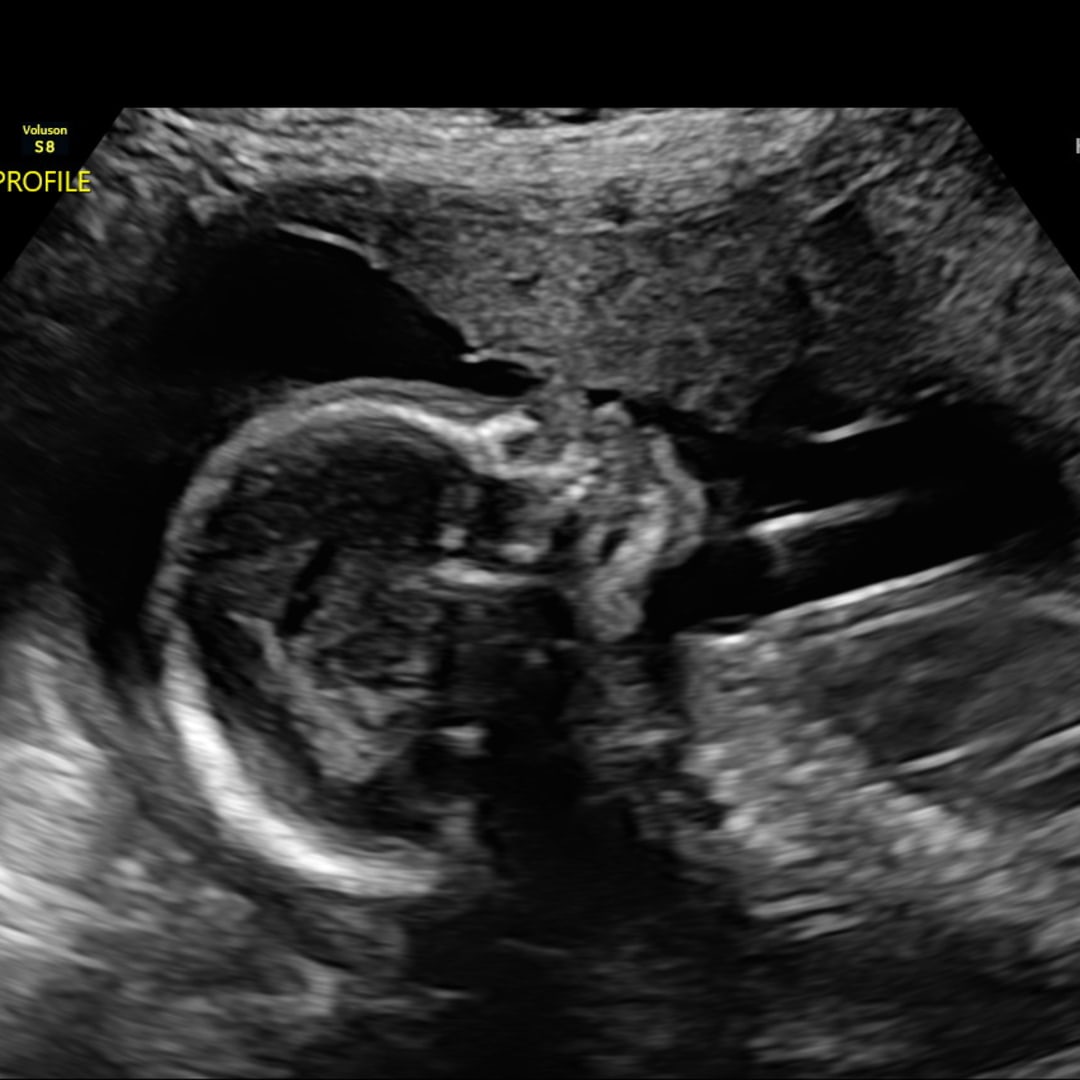 Photo shared by Bebe for their Babylist baby registry.