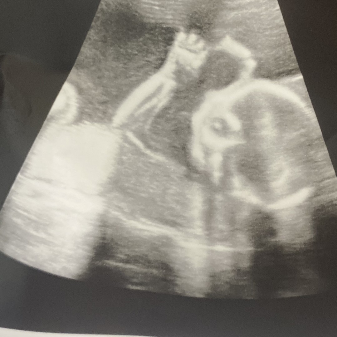 Photo shared by Glorian for their Babylist baby registry.