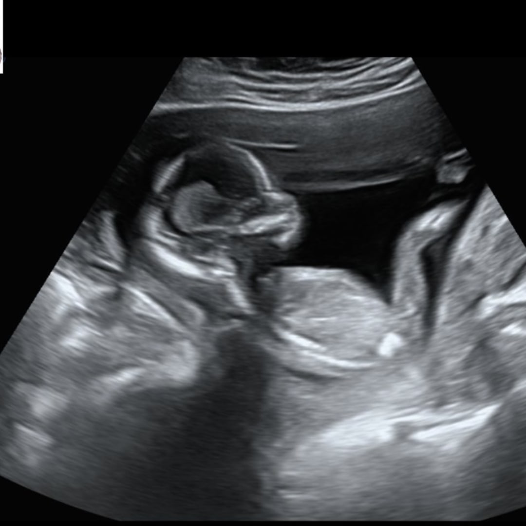 Photo shared by Hailee for their Babylist baby registry.