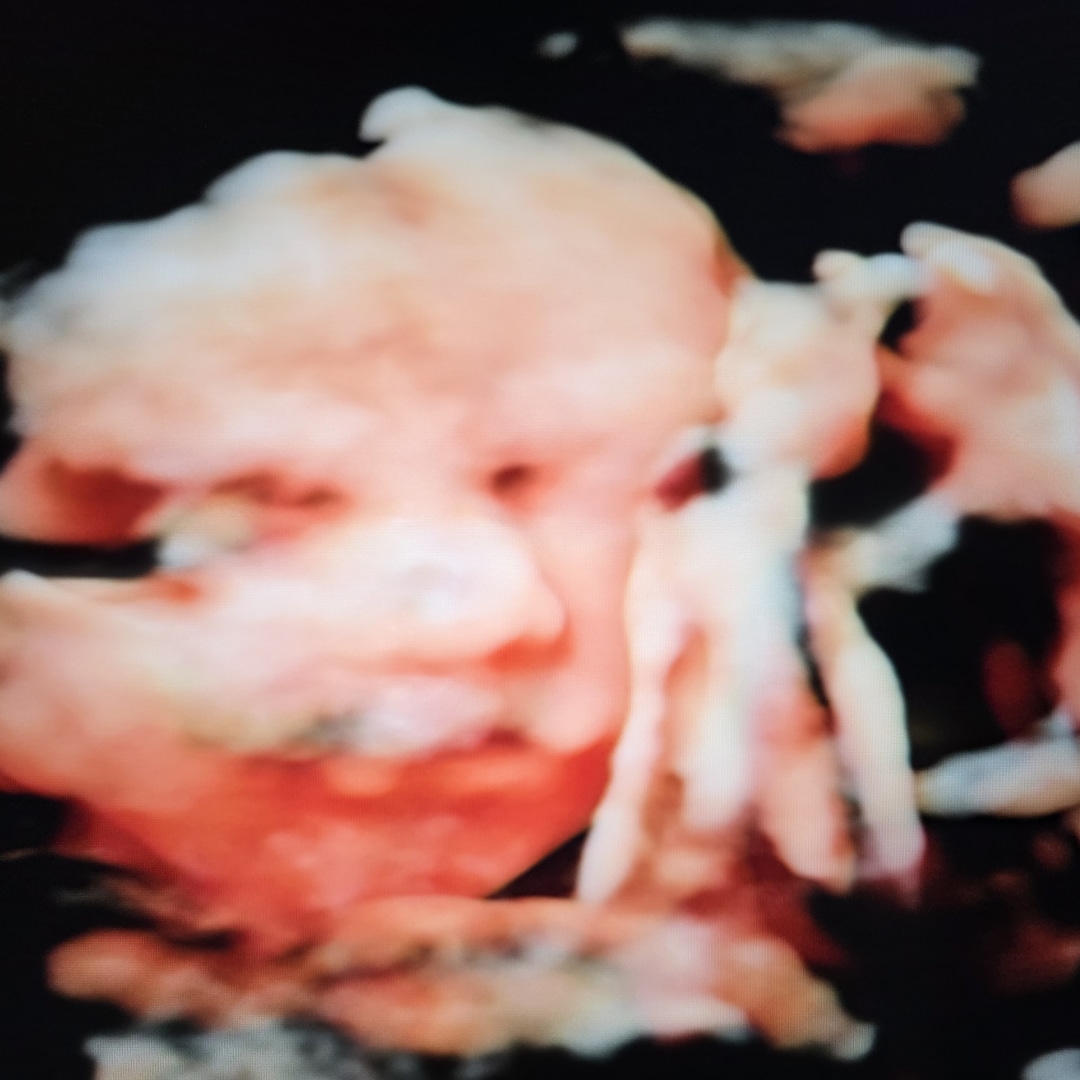 Photo shared by Tiffany for their Babylist baby registry.