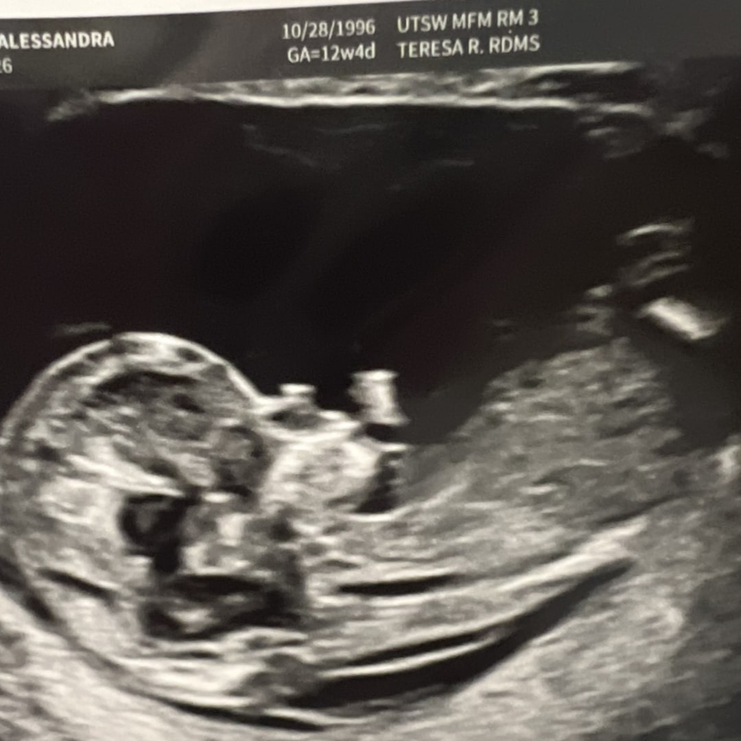 Photo shared by Alessandra for their Babylist baby registry.