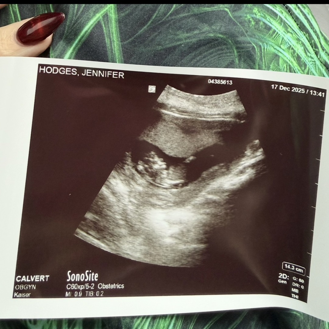 Photo shared by Jennifer for their Babylist baby registry.