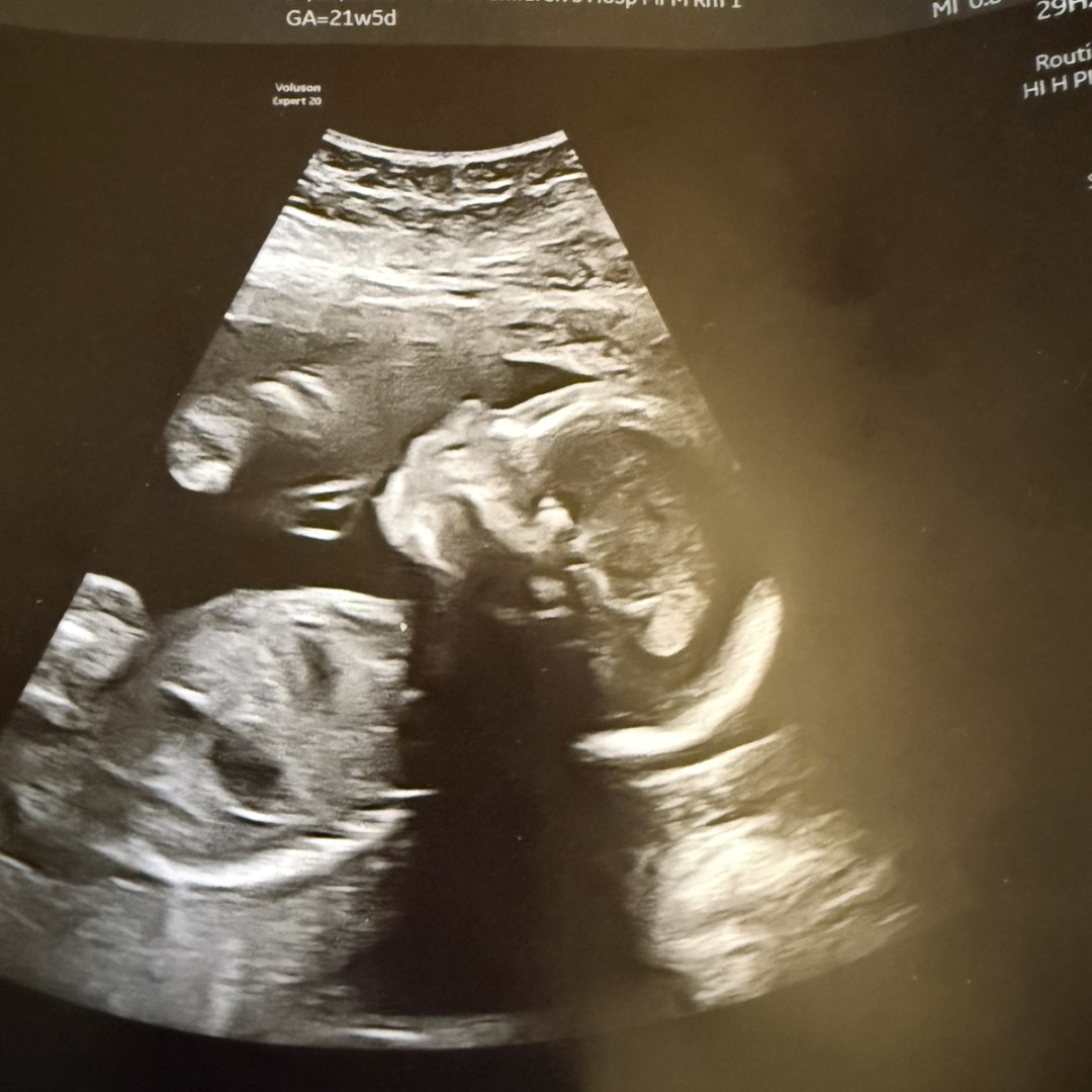 Photo shared by Nichole for their Babylist baby registry.