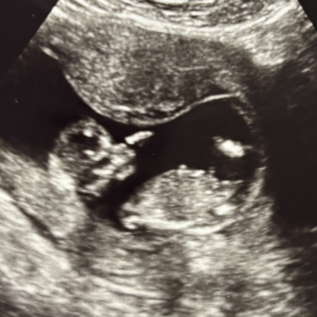 Photo shared by Imaani for their Babylist baby registry.