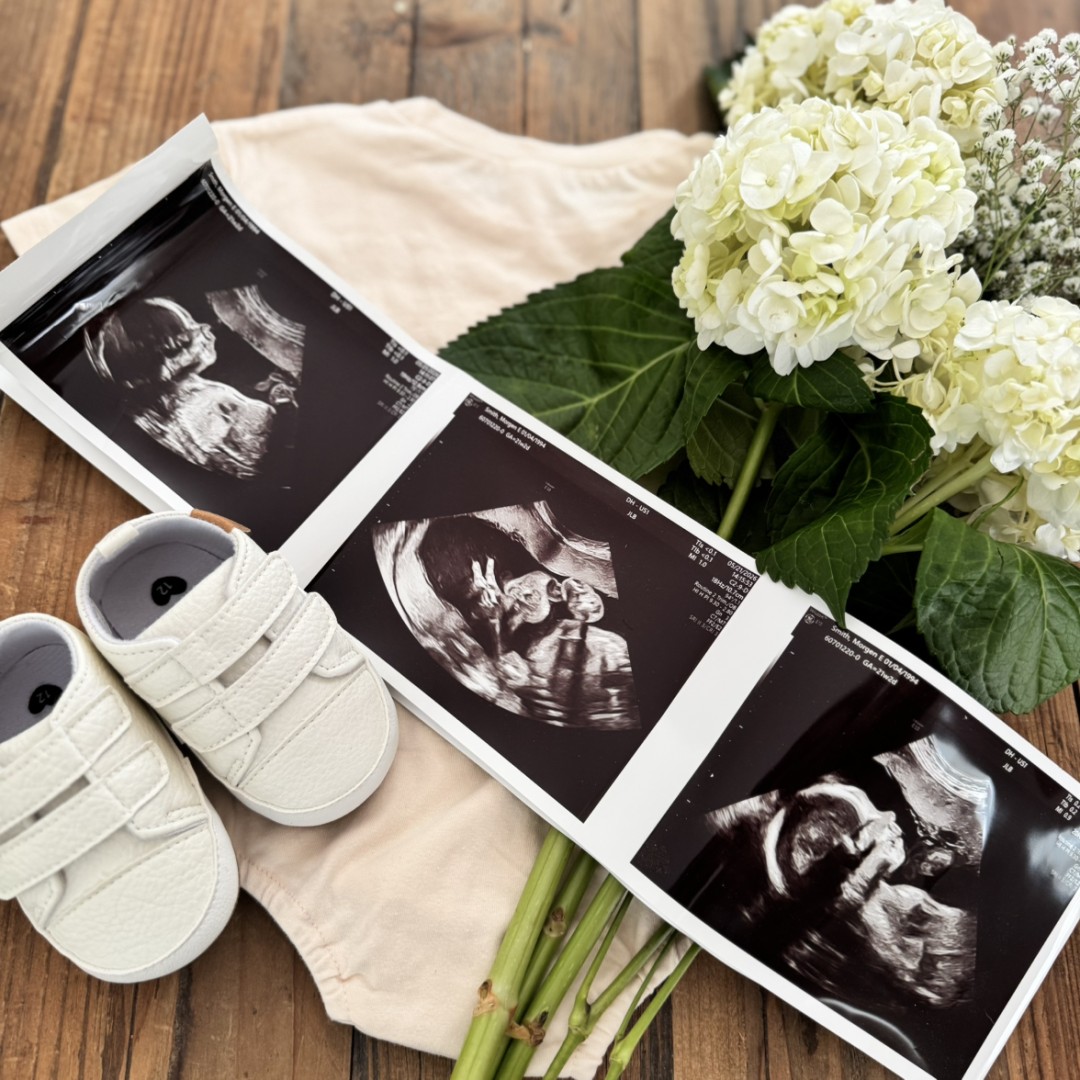 Photo shared by Morgen for their Babylist baby registry.