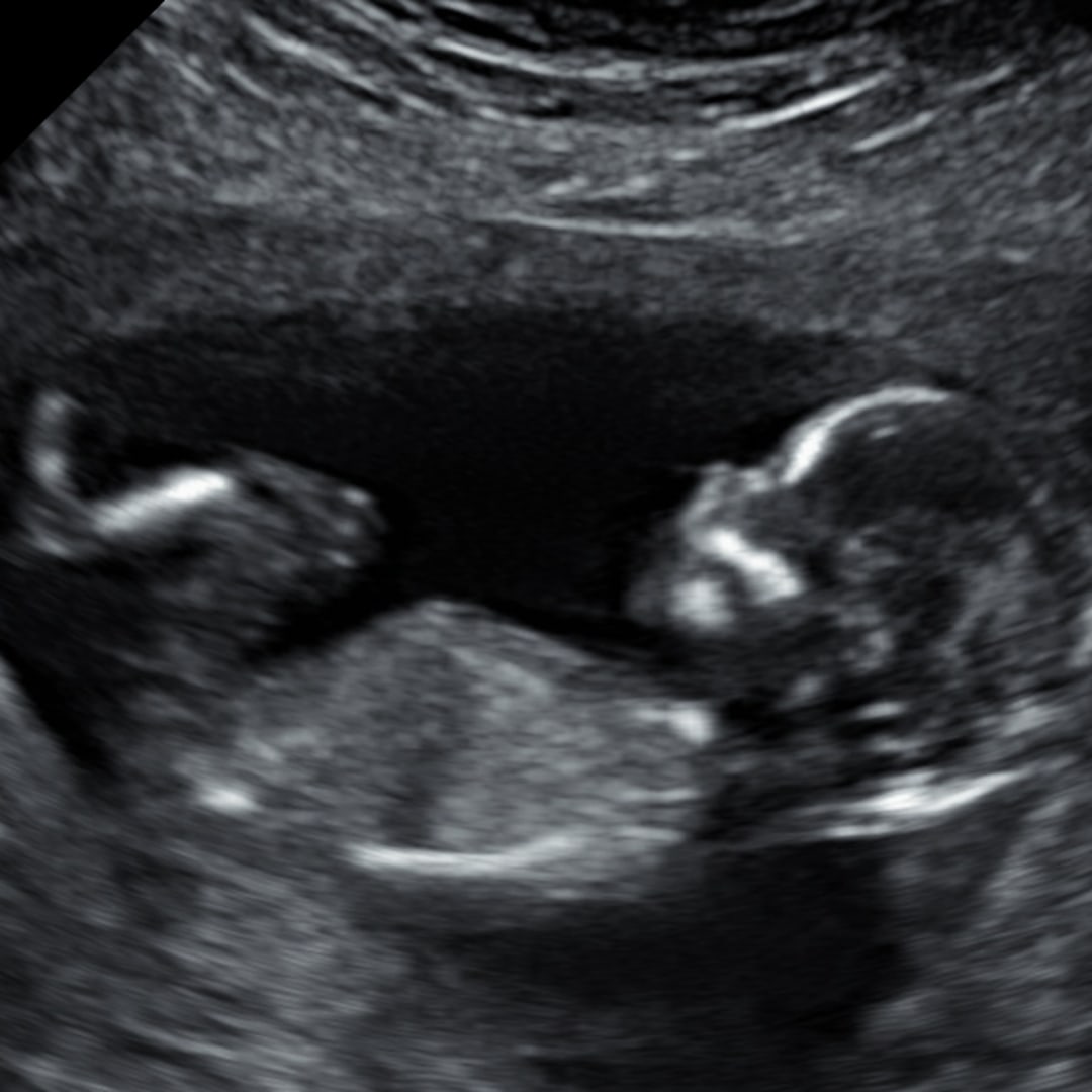 Photo shared by Katelyn for their Babylist baby registry.