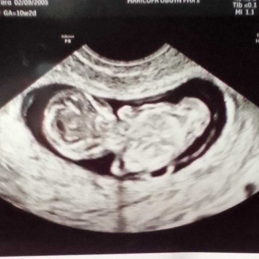 Photo shared by Tara for their Babylist baby registry.